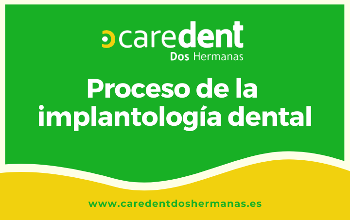 Proceso de la implantología dental